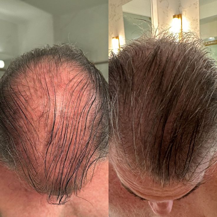 GHK-Cu Copper Peptide Hair & Scalp Serum