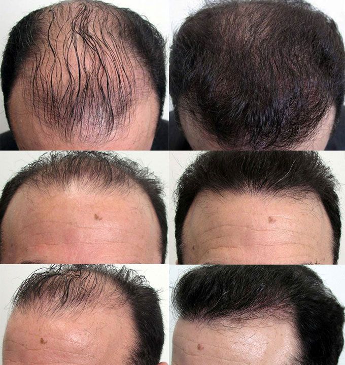 GHK-Cu Copper Peptide Hair & Scalp Serum