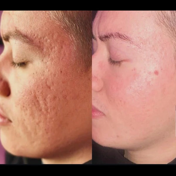 Copper Peptide Serum (GHK-Cu + HA)